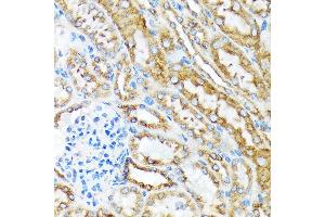 Immunohistochemistry of paraffin-embedded mouse kidney using MSP/MST1 Rabbit mAb (ABIN1680891, ABIN1680890, ABIN3015057 and ABIN3015058) at dilution of 1:100 (40x lens). (MST1 anticorps)