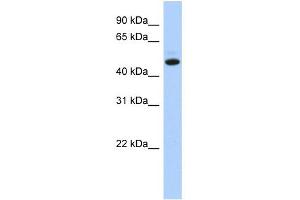 WB Suggested Anti-C5orf36 Antibody Titration: 0. (C5orf36 anticorps  (N-Term))