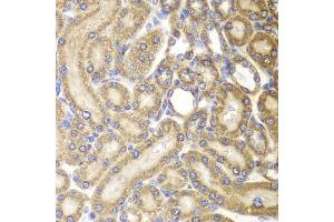 Immunohistochemistry of paraffin-embedded rat kidney using HSPD1 antibody (ABIN5970357) at dilution of 1/100 (40x lens). (HSPD1 anticorps)