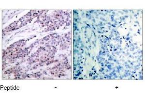 Image no. 1 for anti-B-Cell CLL/lymphoma 2 (BCL2) (AA 54-58) antibody (ABIN197202) (Bcl-2 anticorps  (AA 54-58))