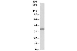 Western blot testing of Daudi lysate with SLC9A3R2 antibody at 1ug/ml. (SLC9A3R2 (Isoforms b & E) anticorps)