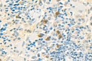 Immunohistochemistry analysis of paraffin-embedded mouse spleen using PPP2R2A (ABIN7075274) at dilution of 1: 2000 (PPP2R2A anticorps)