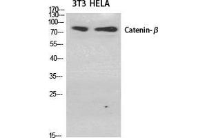 Western Blot (WB) analysis of specific cells using Catenin-beta Polyclonal Antibody. (beta Catenin anticorps  (Ser29))