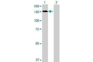 Lane 1: RAB6IP1 transfected lysate ( 147. (RAB6IP1 293T Cell Transient Overexpression Lysate(Denatured))