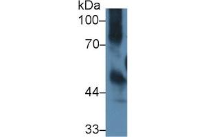 Detection of ICAM1 in Mouse Thymus lysate using Polyclonal Antibody to Intercellular Adhesion Molecule 1 (ICAM1) (ICAM1 anticorps  (AA 328-465))