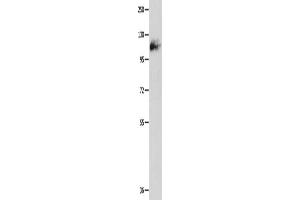 Western Blotting (WB) image for anti-Amphiphysin (AMPH) antibody (ABIN2427737) (Amphiphysin anticorps)