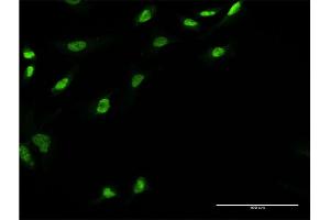 Immunofluorescence of monoclonal antibody to UBE2E3 on HeLa cell. (UBE2E3 anticorps  (AA 65-152))