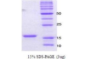 Figure annotation denotes ug of protein loaded and % gel used. (alpha Synuclein A30P A53T (active) Protéine)