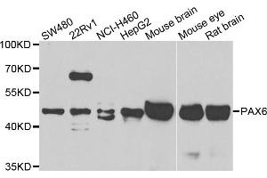 Western blot analysis of extracts of various cell lines, using PAX6 antibody (ABIN5975500) at 1/1000 dilution. (PAX6 anticorps)