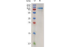 QSOX1 Protein (AA 30-706) (His tag)