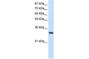 SCYE1 antibody used at 0. (AIMP1 anticorps)