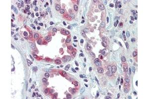 IHC testing of FFPE human kidney tissue with SNAIL antibody at 5ug/ml. (SNAIL anticorps)