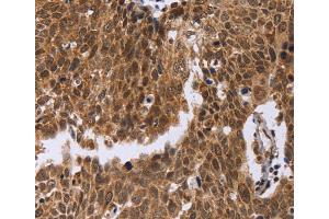 Immunohistochemistry (IHC) image for anti-Excision Repair Cross-Complementing Rodent Repair Deficiency, Complementation Group 6-Like (ERCC6L) antibody (ABIN2423388) (ERCC6L anticorps)