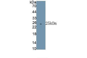 Detection of Recombinant HSPA5, Rat using Polyclonal Antibody to Heat Shock 70 kDa Protein 5 (HSPA5) (GRP78 anticorps  (AA 260-469))