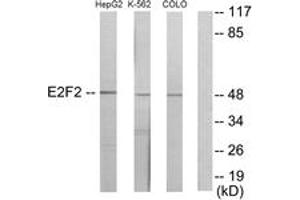 Western Blotting (WB) image for anti-E2F Transcription Factor 2 (E2F2) (AA 221-270) antibody (ABIN2889587) (E2F2 anticorps  (AA 221-270))