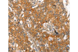 Immunohistochemistry (IHC) image for anti-Matrix Metalloproteinase 2 (MMP2) antibody (ABIN2434292) (MMP2 anticorps)