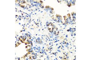 Immunohistochemistry of paraffin-embedded mouse lung using SERPINA7 antibody. (SERPINA7 anticorps)