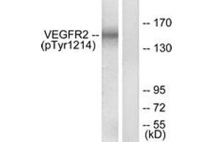 Western Blotting (WB) image for anti-VEGF Receptor 2 (VEGFR2) (pTyr1214) antibody (ABIN2888556) (VEGFR2/CD309 anticorps  (pTyr1214))