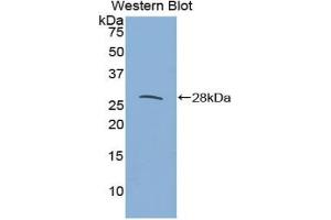 Western blot analysis of the recombinant protein. (IL27 Receptor alpha anticorps  (AA 123-343))