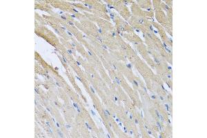 Immunohistochemistry of paraffin-embedded rat heart using CRHBP antibody. (CRHBP anticorps)