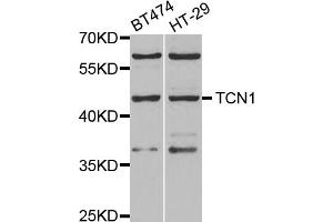 Western blot analysis of extracts of various cell lines, using TCN1 antibody (ABIN5973815) at 1/1000 dilution. (TCN1 anticorps)