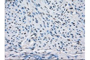 Immunohistochemical staining of paraffin-embedded endometrium tissue using anti-PPP5Cmouse monoclonal antibody. (PP5 anticorps)