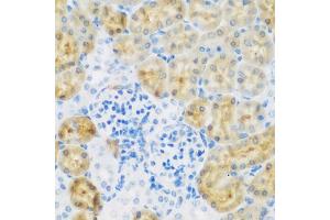 Immunohistochemistry of paraffin-embedded mouse kidney using EGFR antibody (ABIN5997650) at dilution of 1/100 (40x lens). (EGFR anticorps)