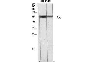 Western Blotting (WB) image for anti-V-Akt Murine Thymoma Viral Oncogene Homolog 1 (AKT1) (Internal Region) antibody (ABIN3183235) (AKT1 anticorps  (Internal Region))