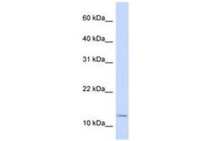 Image no. 1 for anti-Cellular Retinoic Acid Binding Protein 2 (CRABP2) (AA 72-121) antibody (ABIN6743084) (CRABP2 anticorps  (AA 72-121))