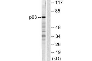 Western Blotting (WB) image for anti-T-Complex 1 (TCP1) (C-Term) antibody (ABIN1848723) (TCP1 alpha/CCTA anticorps  (C-Term))