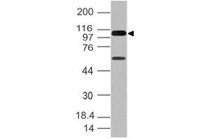 Image no. 1 for anti-DEAD (Asp-Glu-Ala-Asp) Box Polypeptide 58 (DDX58) (AA 1-220) antibody (ABIN5027276) (DDX58 anticorps  (AA 1-220))