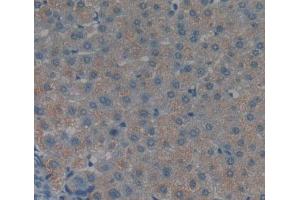 IHC-P analysis of liver tissue, with DAB staining. (TNKS2 anticorps  (AA 959-1166))