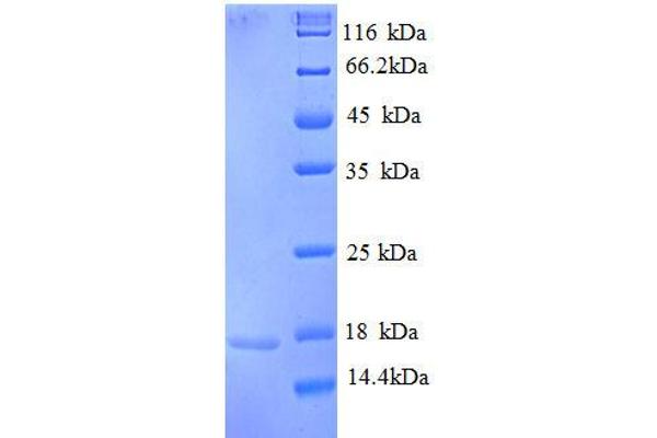 RPA3 Protein (AA 1-119, partial) (His tag)