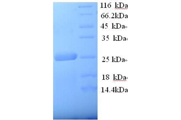 LRP2 Protein (AA 1186-1389, Extracellular) (His tag)