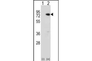 Western blot analysis of MeCP2 (arrow) using rabbit polyclonal MeCP2 Antibody  (ABIN650709 and ABIN2839306). (MECP2 anticorps  (C-Term))