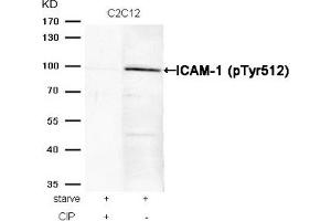 Western blot analysis of extracts from C2C12 cells, treated with starve or calf intestinal phosphatase (CIP), using ICAM-1 (Phospho-Tyr512) Antibody. (ICAM1 anticorps  (pTyr512))