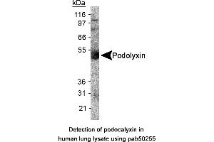Image no. 1 for anti-Podocalyxin-Like (PODXL) (AA 100-200), (Internal Region) antibody (ABIN363564) (PODXL anticorps  (Internal Region))