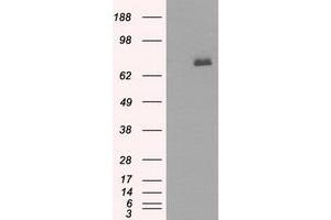 Western Blotting (WB) image for anti-Bruton Agammaglobulinemia tyrosine Kinase (BTK) antibody (ABIN1496977) (BTK anticorps)