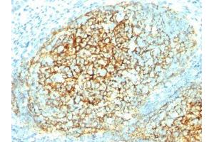 Image no. 1 for anti-Vascular Cell Adhesion Molecule 1 (VCAM1) antibody (ABIN6157708) (VCAM1 anticorps)