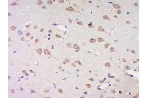 Paraformaldehyde-fixed, paraffin embedded rat brain tissue, Antigen retrieval by boiling in sodium citrate buffer(pH6) for 15min, Block endogenous peroxidase by 3% hydrogen peroxide for 30 minutes, Blocking buffer (normal goat serum) at 37°C for 20min, Antibody incubation with Rabbit Anti-Casein kinase I isoforms gamma 1+2+3 (Tyr263) Polyclonal Antibody, Unconjugated  at 1:500 overnight at 4°C, followed by a conjugated secondary and DAB staining (CSNK1G1, CSNK1G2, CSNK1G3 (pTyr263) anticorps)