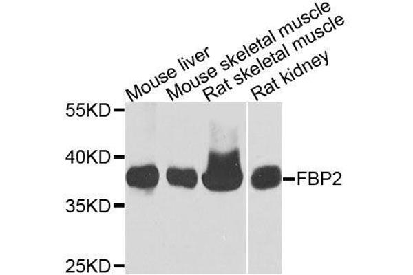 FBP2 anticorps  (AA 1-339)