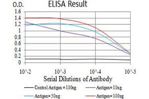 Black line: Control Antigen (100 ng);Purple line: Antigen (10ng); Blue line: Antigen (50 ng); Red line:Antigen (100 ng) (MIB1 anticorps  (AA 6-221))