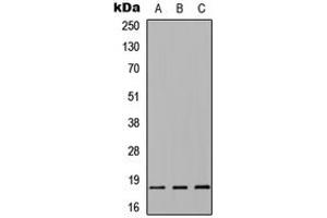 Western blot analysis of Alpha-synuclein expression in HEK293T (A), Raw264. (SNCA anticorps  (Center))