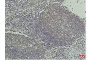 Immunohistochemistry (IHC) analysis of paraffin-embedded Human Tonsil Tissue using TNF a Mouse Monoclonal Antibody diluted at 1:50. (TNF alpha anticorps)