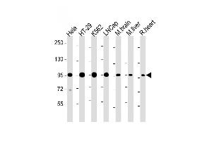 Western Blotting (WB) image for anti-SREBF chaperone (SCAP) (AA 604-632) antibody (ABIN652508)