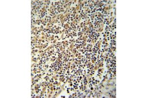 NLRP3 Antibody (N-term) (ABIN652504 and ABIN2842339) immunohistochemistry analysis in formalin fixed and paraffin embedded human lymph tissue followed by peroxidase conjugation of the secondary antibody and DAB staining. (NLRP3 anticorps  (N-Term))