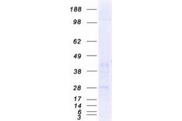 CTRP6 Protein (Transcript Variant 1) (Myc-DYKDDDDK Tag)