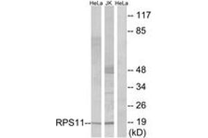 Western blot analysis of extracts from HeLa/Jurkat cells, using RPS11 Antibody. (RPS11 anticorps  (AA 71-120))