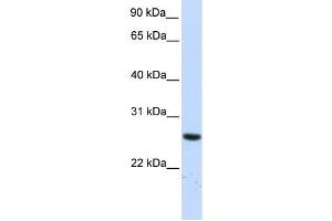 TTC33 antibody used at 1 ug/ml to detect target protein. (TTC33 anticorps  (N-Term))