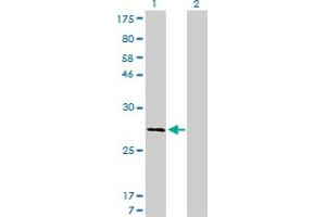 Western Blotting (WB) image for anti-Calpain, Small Subunit 1 (CAPNS1) (AA 172-260) antibody (ABIN598500) (Calpain S1 anticorps  (AA 172-260))